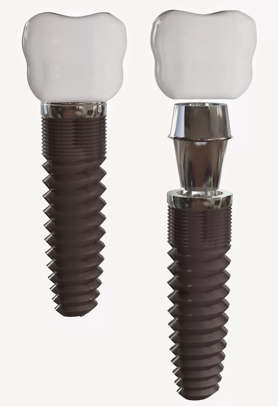 JB Dentistry Picture 10