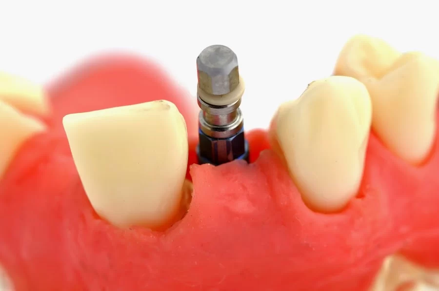 JB Dentistry Picture 4