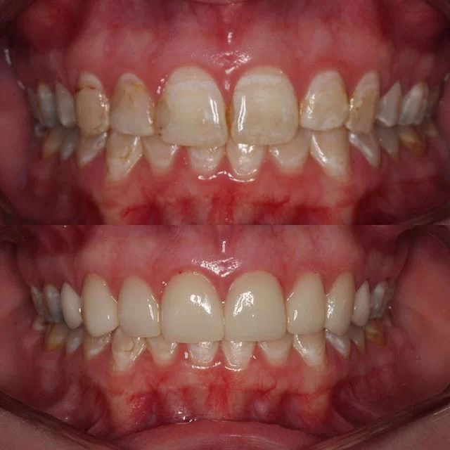 Blessed Smile Dentistry of Diamond Bar Picture 4