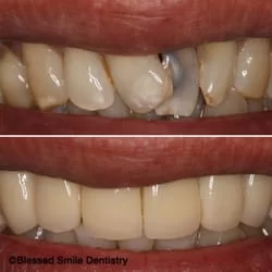 Blessed Smile Dentistry of Diamond Bar Picture 1