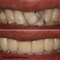 Blessed Smile Dentistry of Diamond Bar ico