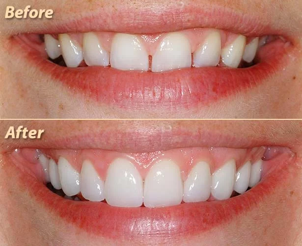 Blessed Smile Dentistry of Diamond Bar Picture 3