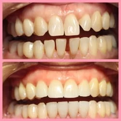 Blessed Smile Dentistry of Diamond Bar Picture 2