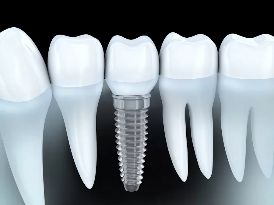 Dental Service Picture 3