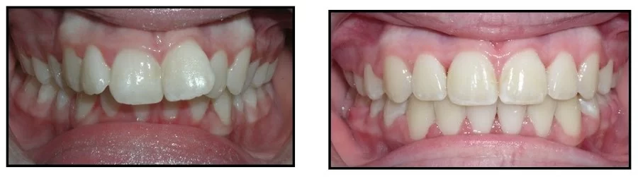 Allstar Dental Picture 2
