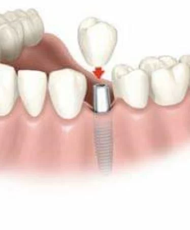 Kassab Dental Picture 2