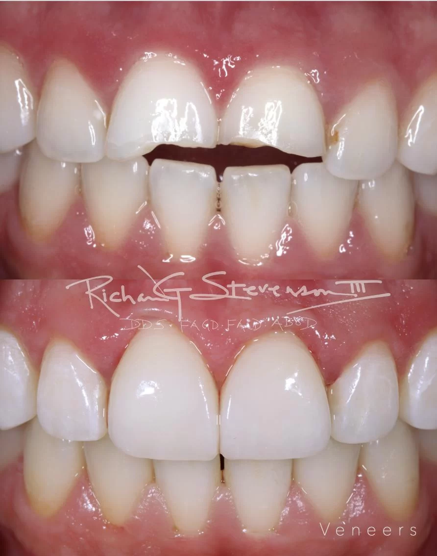 Stevenson Dental Solutions Picture 9