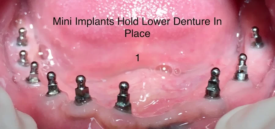 San Dimas Family and Sedation Dentistry Picture 5