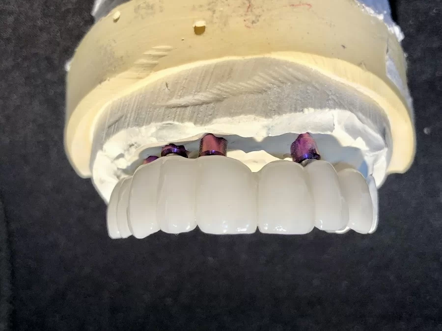 San Dimas Family and Sedation Dentistry Picture 8