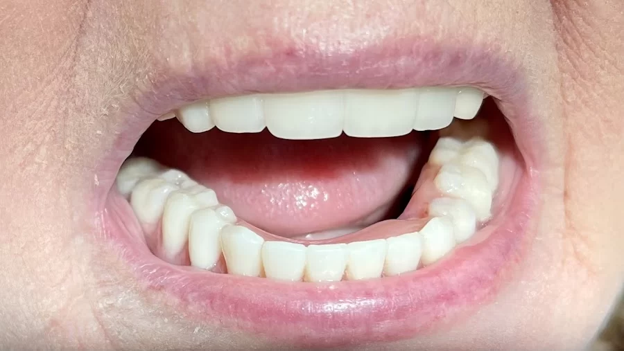 San Dimas Family and Sedation Dentistry Picture 6