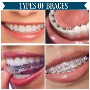 Agoura Dental & Braces Picture 1