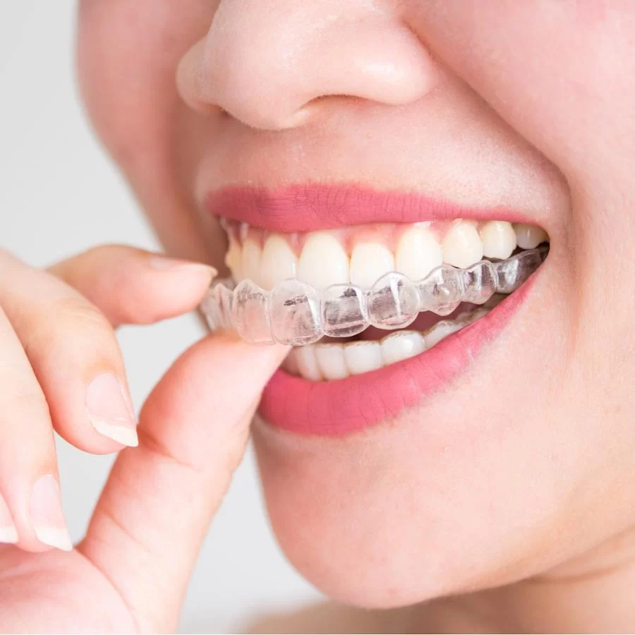 Bull Mountain Orthodontics Picture 10