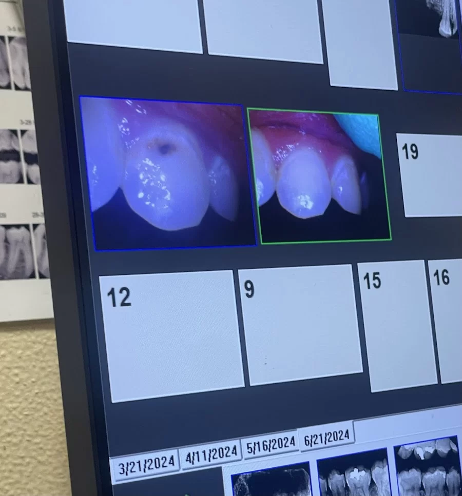 Family Dentistry Picture 5