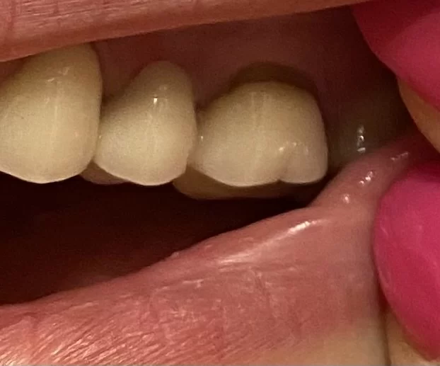 Mortenson Family Dental Picture 2