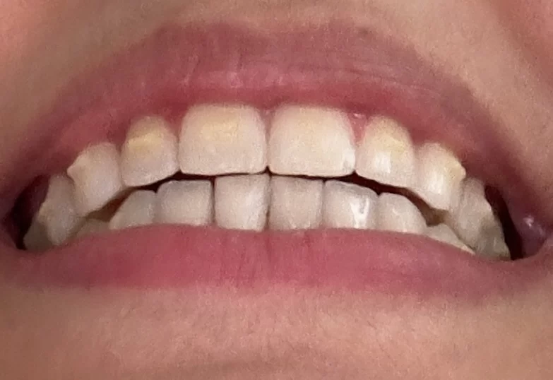 Vivian Maung DDS, MS - Maung Orthodontics - Orthodontist Picture 3