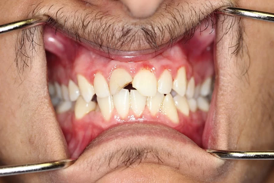 Emigh Dental Care Picture 5