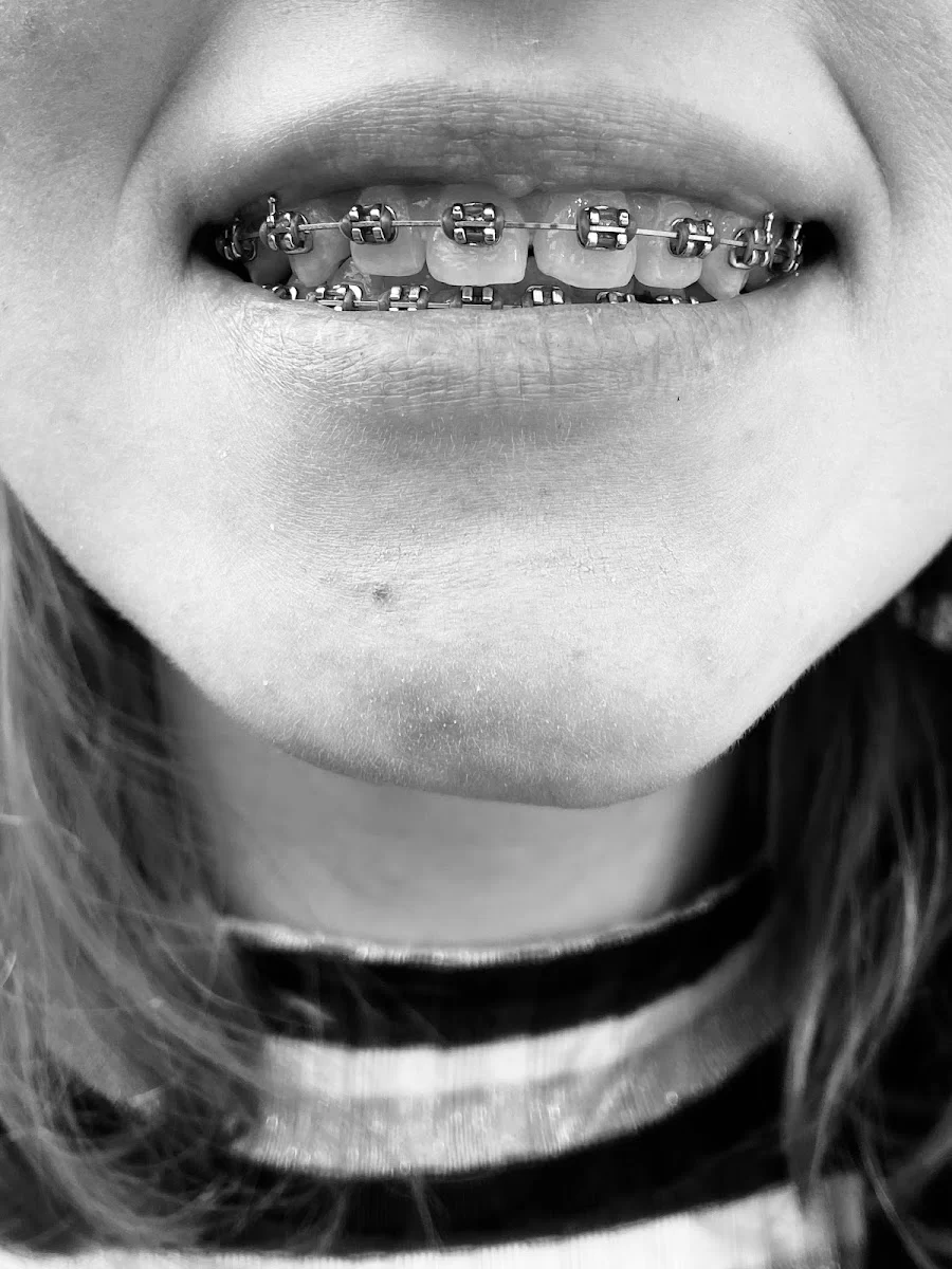 Leizer Orthodontics Picture 8
