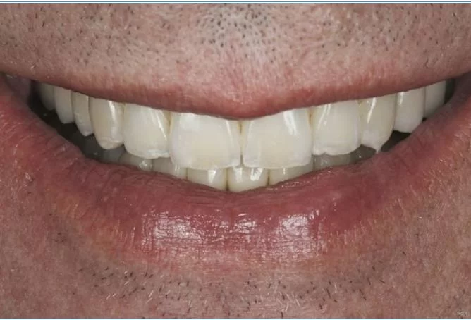 Boston Prosthodontics Dental Group Picture 9