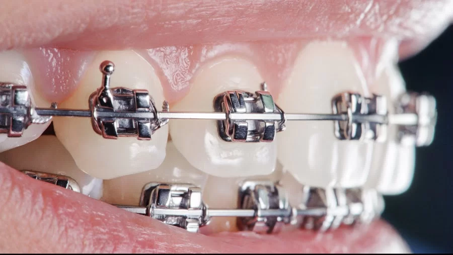 Eco Dental Implant Center Picture 5