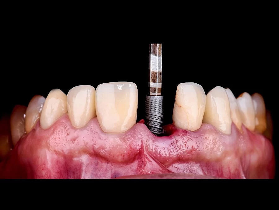 Eco Dental Implant Center Picture 4