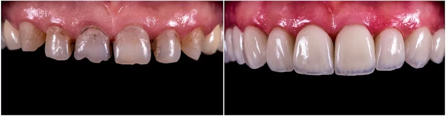 Eco Dental Implant Center Picture 1