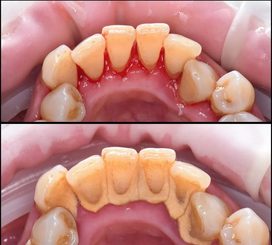 Eco Dental Implant Center Picture 6