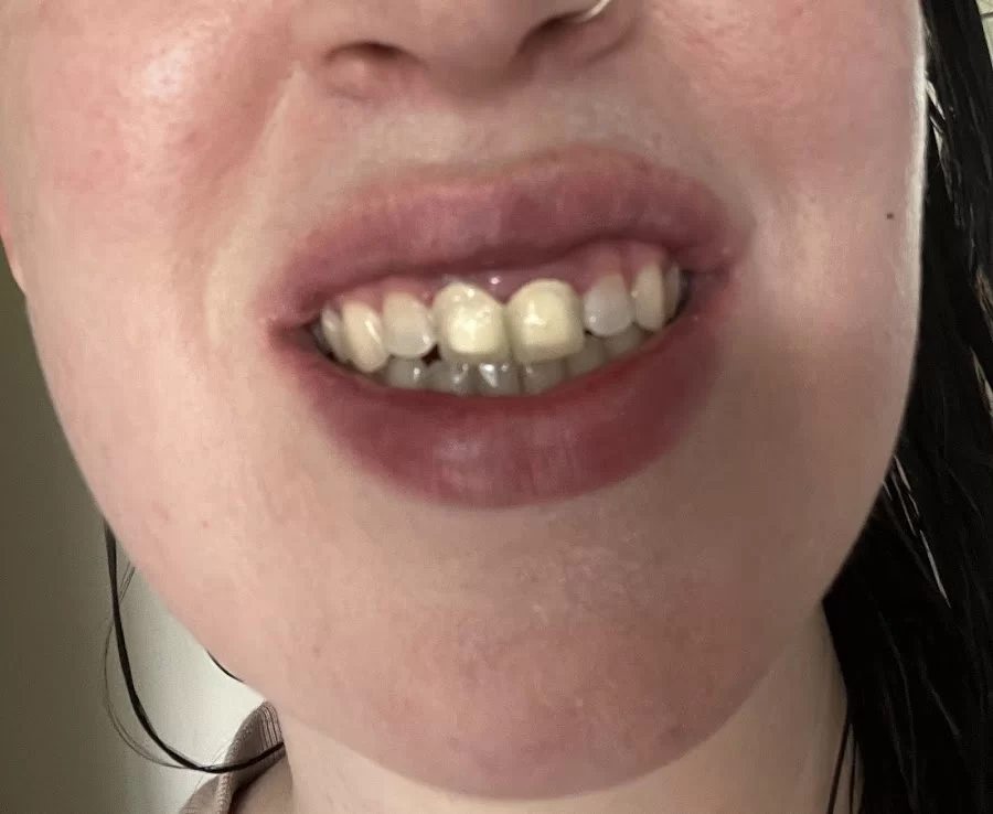 Bright Now! Dental & Orthodontics Picture 1