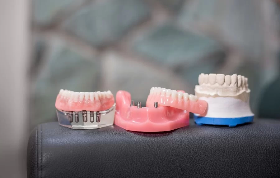 Mercer Island Dental - Invisalign and Sleep Apnea Dentist Picture 4