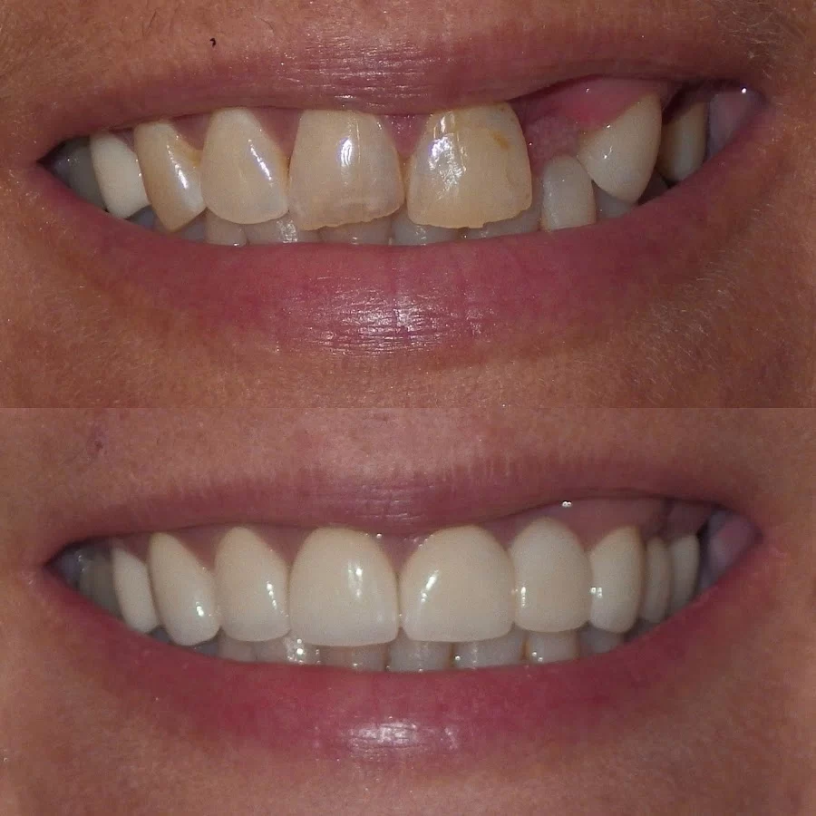 Power Ranch Dental Picture 6
