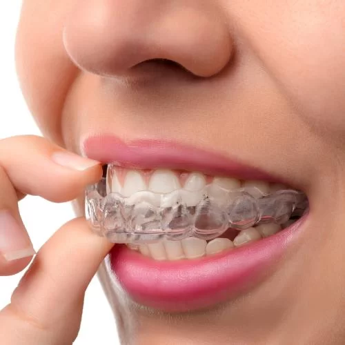 Bellevue Dental Care and Implant Center Picture 7