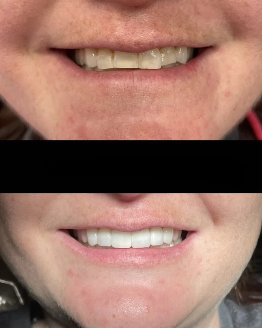 Glisten Dental Studio Picture 7