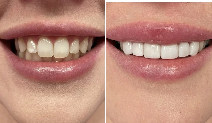 Glisten Dental Studio Picture 4