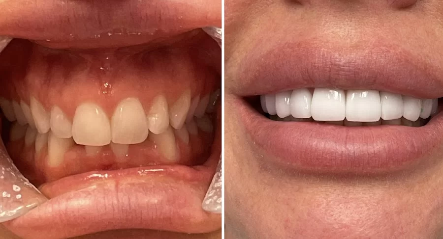 Glisten Dental Studio Picture 1