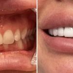 Glisten Dental Studio