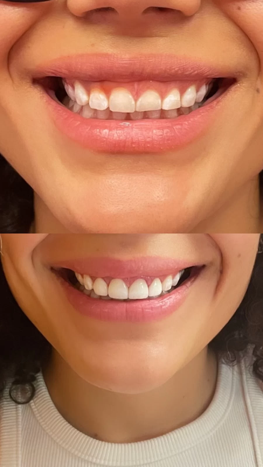 Glisten Dental Studio Picture 8
