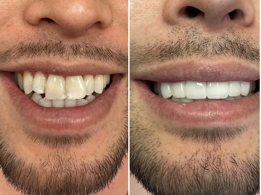 Glisten Dental Studio Picture 5