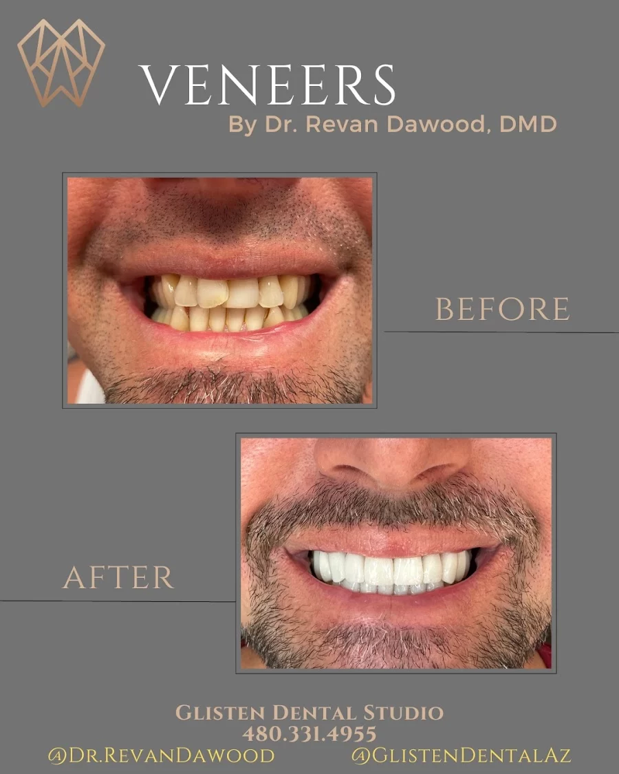 Glisten Dental Studio Picture 6