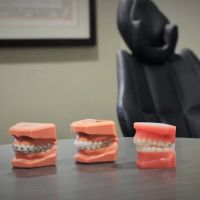 Leone and Vaughn Orthodontics ico