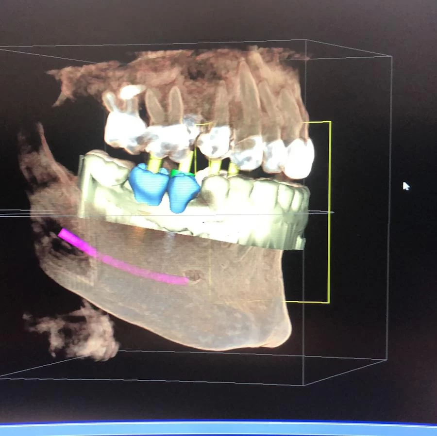 Queen Creek Complete Dental Picture 10