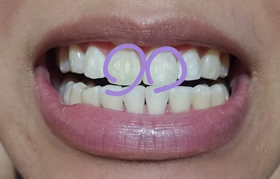 Pacific Coast Dentist: Navneet Sekhon DDS Picture 5