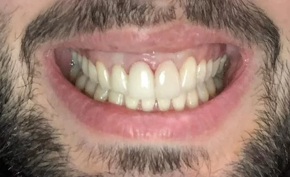 Seven Hills Dental Group Picture 4