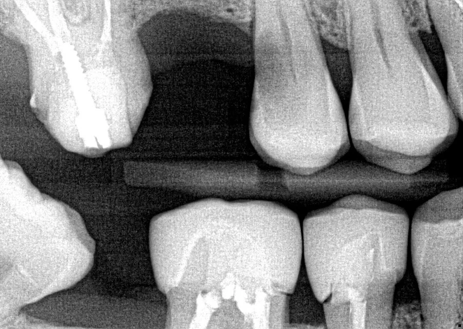 Seven Hills Dental Group Picture 8