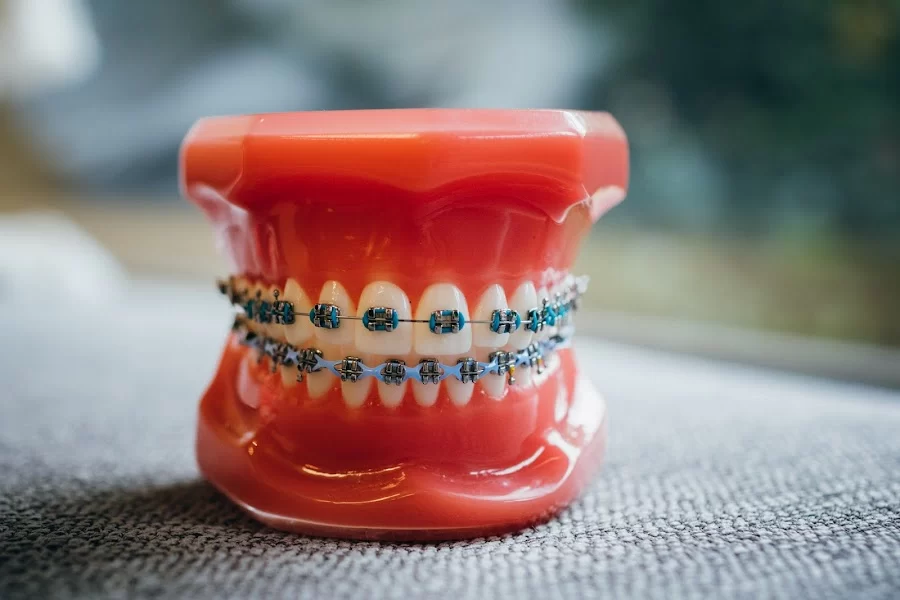 Amrit Burn Orthodontics Picture 2