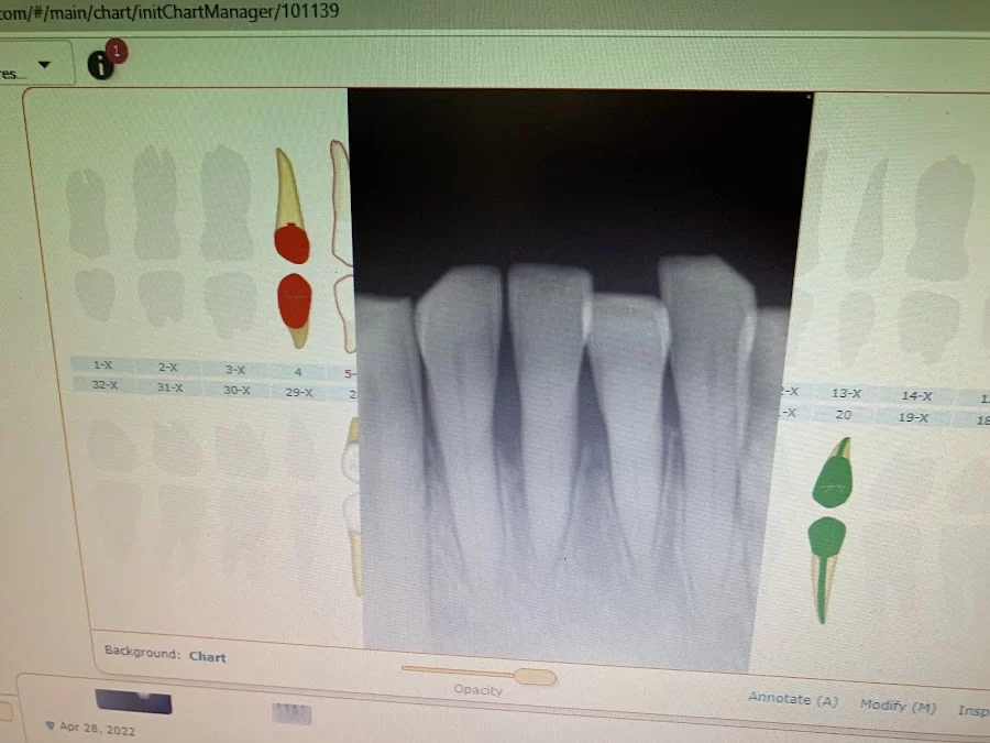 Access Dental, Dentures & Implants Picture 2