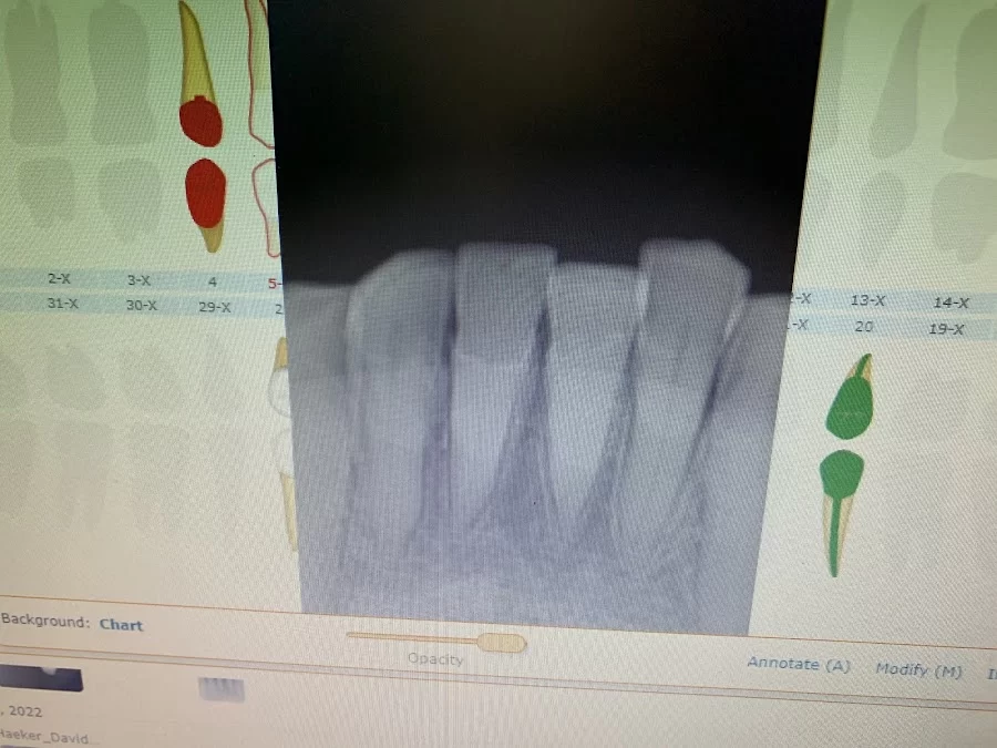 Access Dental, Dentures & Implants Picture 3