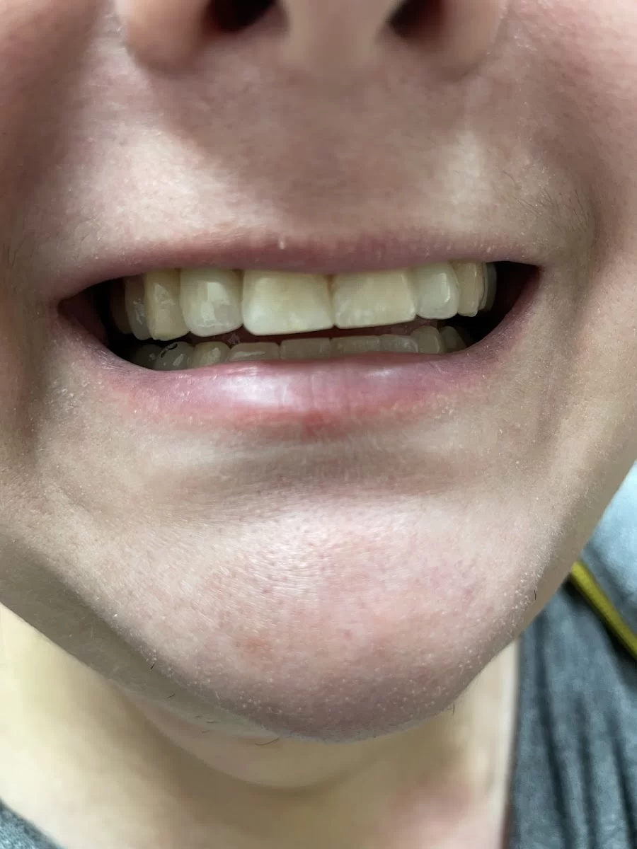 Elevation Dental Picture 3