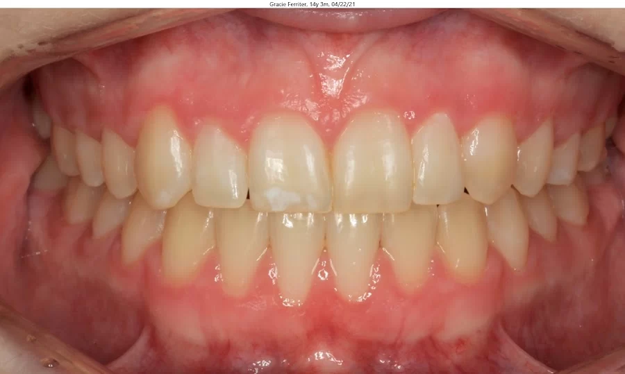 Elevation Dental Picture 1