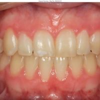 Elevation Dental ico