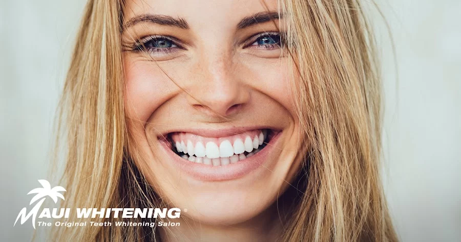 Maui Whitening Orlando Picture 4