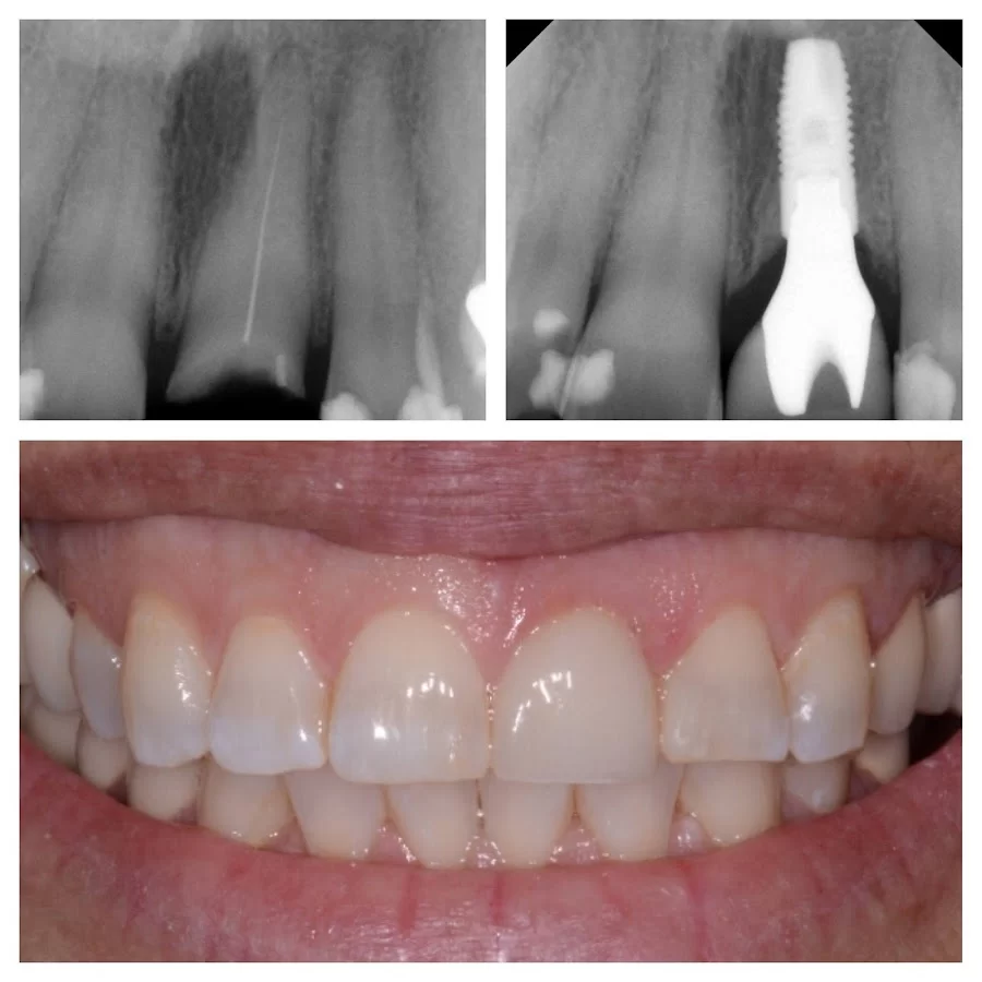 Rose Cosmetic & Family Dentistry Picture 6